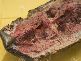 melancia