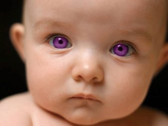 olhos roxos