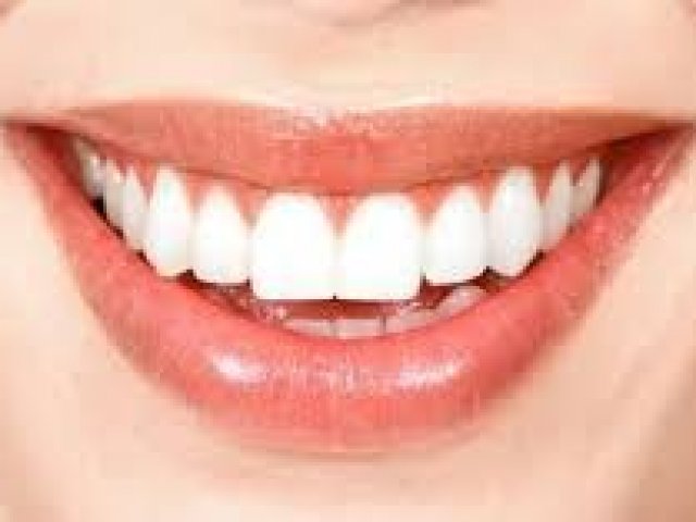 Dentes saudáveis precisam ser branquíssimos