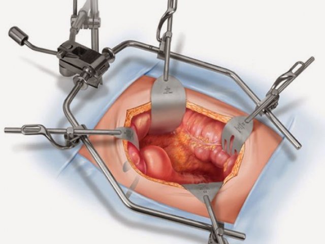 Cirurgia Geral!