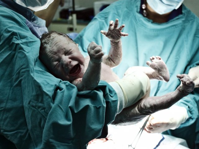 Cirurgia Obstétrica!